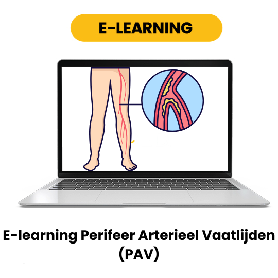 E-learning Perifeer Arterieel Vaatlijden (PAV)